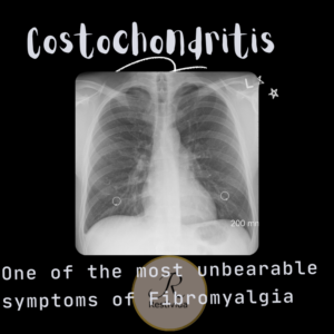 Costochonritis