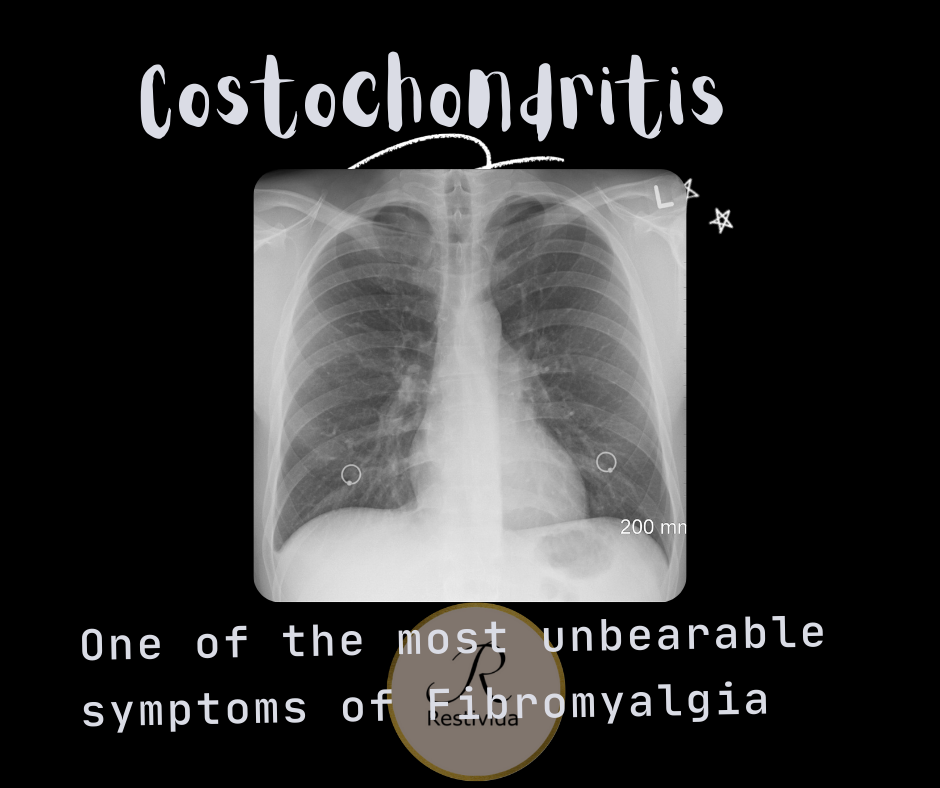 Costochonritis