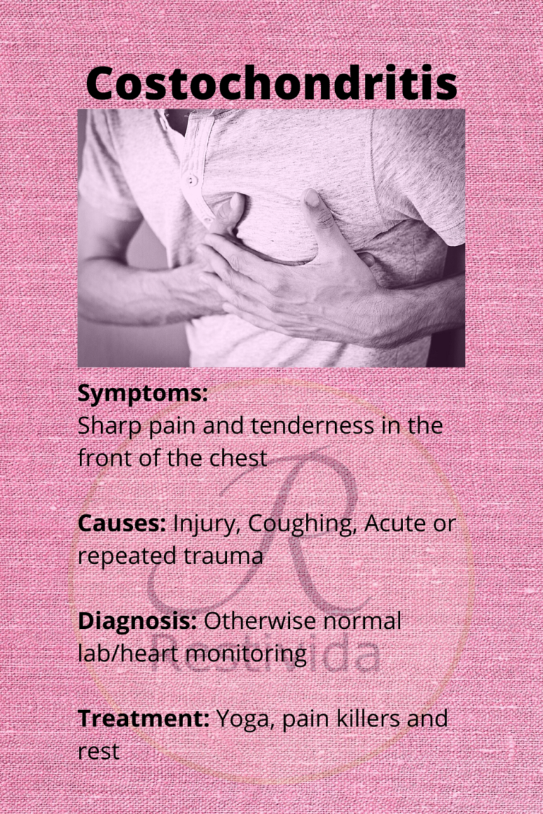 Costochondritis